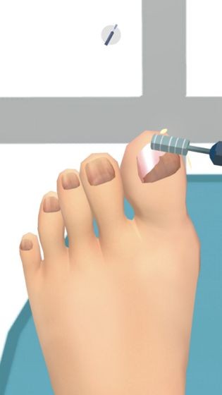 老板修个脚甲沟炎(FootClinic)